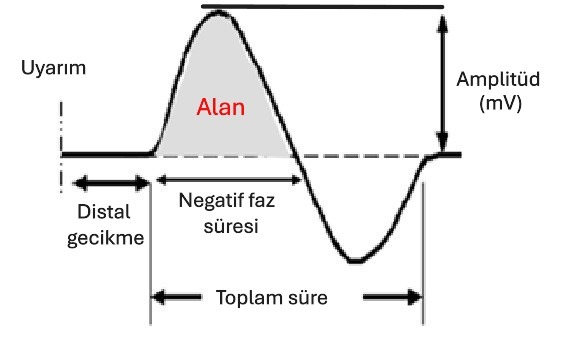 Duyusal sinir iletim çalışmasının EMG cihazındaki kaydı